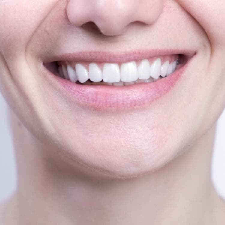 Botox Without the Hype – Just Glow & Confidence